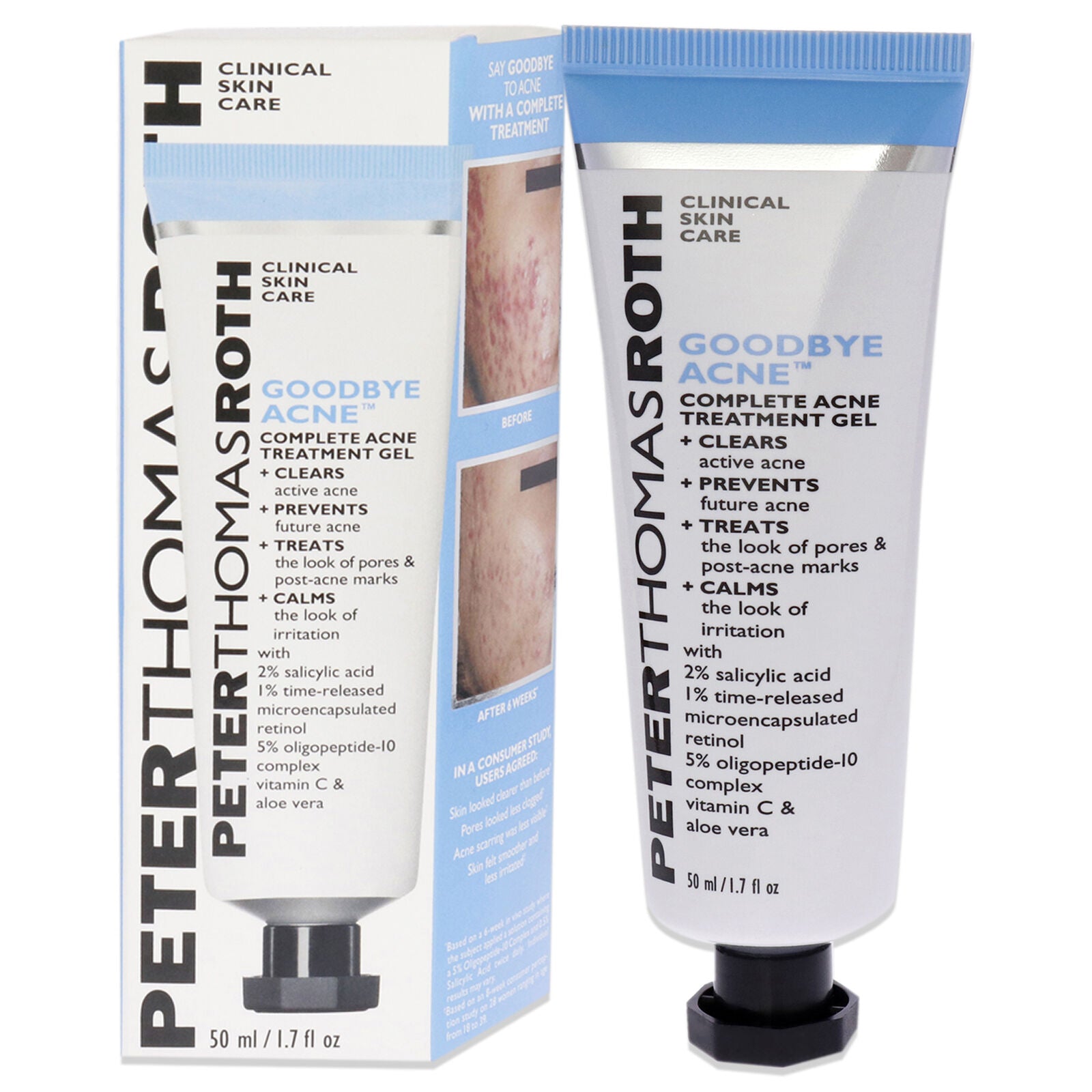 Peter Thomas Roth Goodbye Acne Complete Acne Treatment Gel 1.7 oz